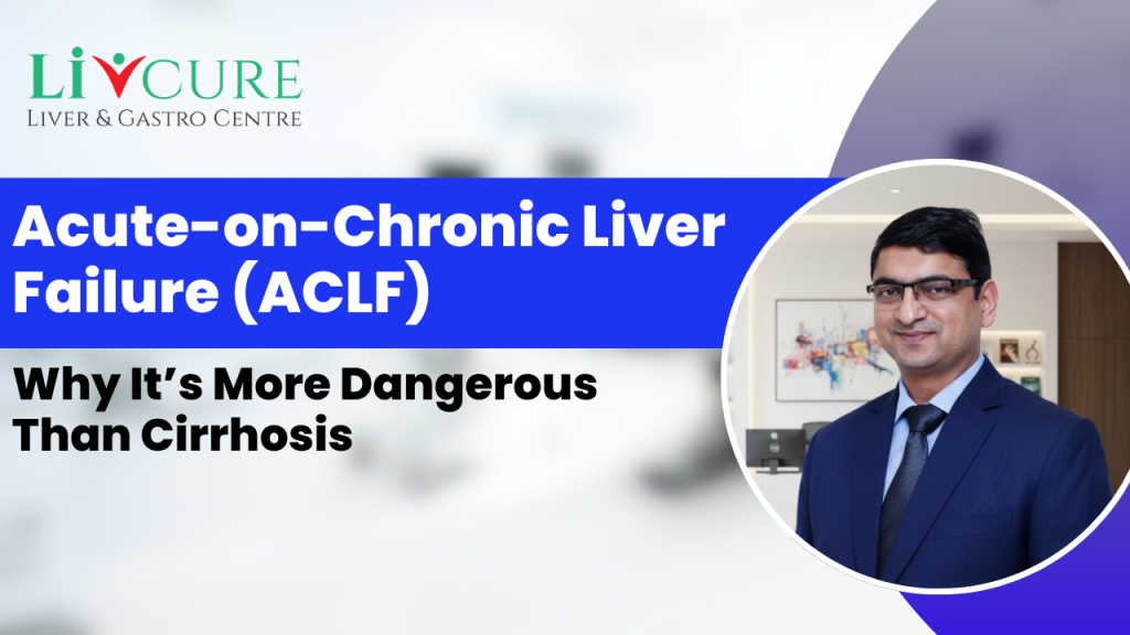 Acute-on-Chronic Liver Failure