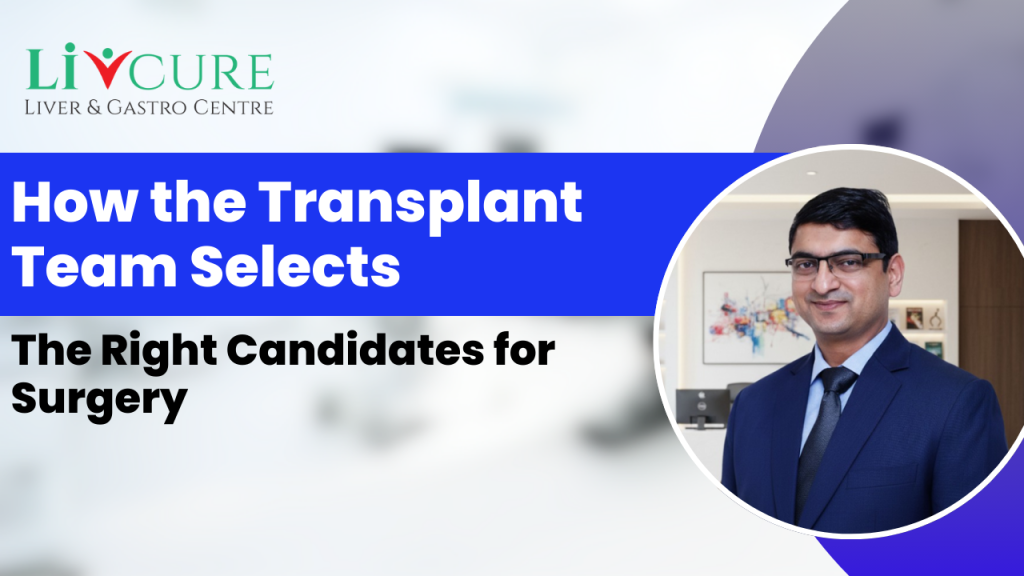 liver transplant selection process