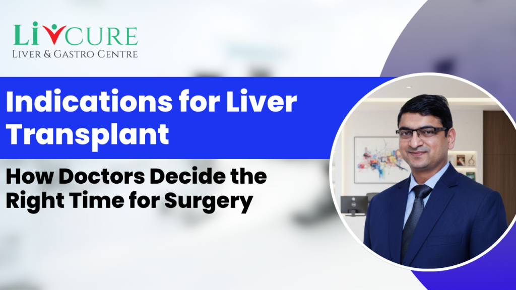 Right time for liver transplant