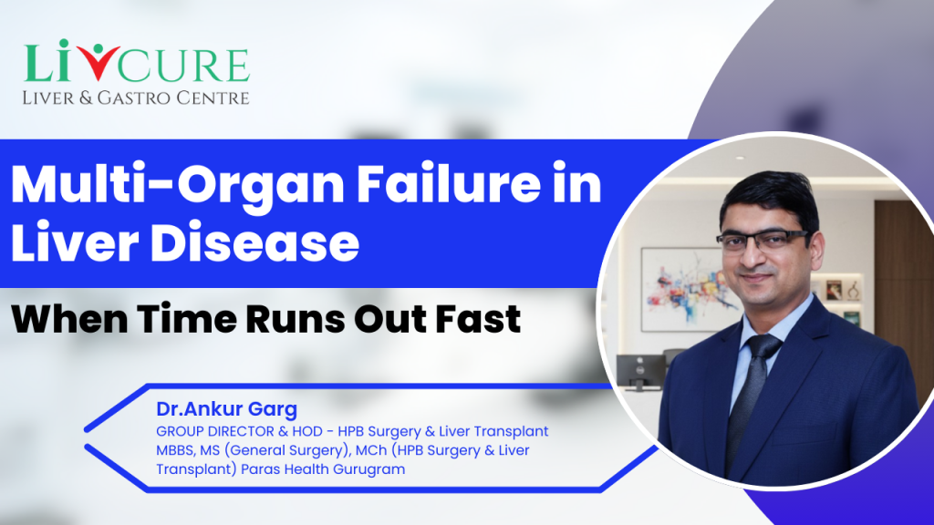 Multi-organ failure in liver disease